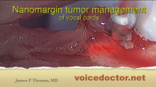 Nanomargin tumor management laser treatment of a vocal cord